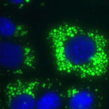 Voir la vidéo de Protéine prion : ce que l&#039;on sait, ce que l&#039;on ne sait pas...