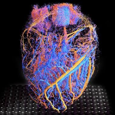 Voir la vidéo de Première mondiale : des organes en 4 dimensions !
