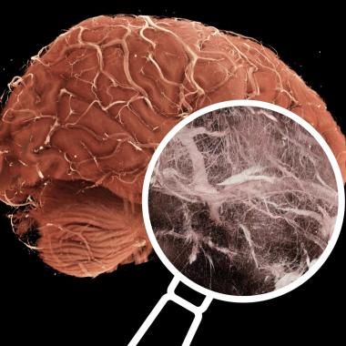 Voir la vidéo de Ils cartographient le corps humain avec une définition folle !