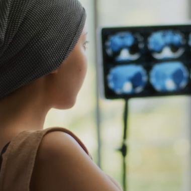 Voir la vidéo de Pourquoi les cancers explosent-ils chez les moins de 50 ans ? 