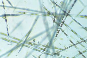 Mieux comprendre les proliférations d’algues toxiques grâce au projet MaSCoET