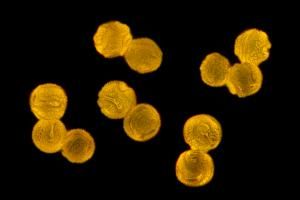 grains de pollens au microscope