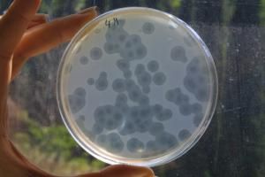 Les infections bactériennes, deuxième cause de décès dans le monde 
