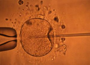 La concentration en spermatozoïdes connaîtrait un déclin mondial depuis plusieurs décennies