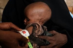 Mortalité infantile « alarmante » dans le monde, selon l’ONU