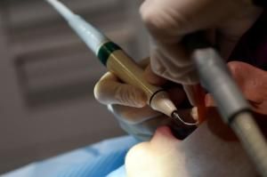 Cherbourg : les patients d&#039;un dentiste appelés à se faire dépister