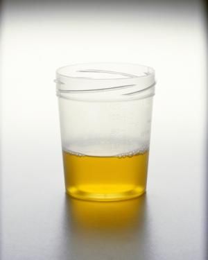 Pourquoi l’urine est-elle jaune ? 