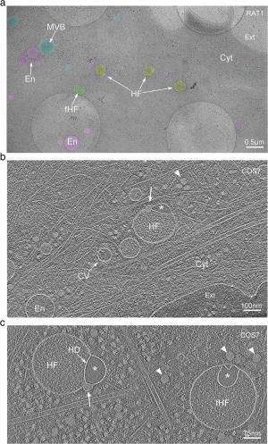 Des scientifiques découvrent un organite inconnu à l&#039;intérieur de nos cellules