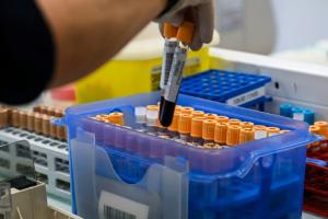 Tests ADN en accès libre : la question sensible d’une légalisation relancée en France 