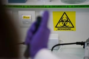 Virus Shamonda : première détection chez un humain, en France, pas de risque sanitaire global identifié 