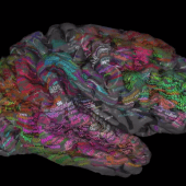 À chaque mot sa place dans le cerveau