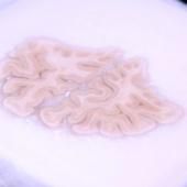 Un cerveau reconstruit post mortem 