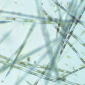 Mieux comprendre les proliférations d’algues toxiques grâce au projet MaSCoET