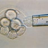 Diagnostic pré-implantatoire : polémique autour du tri d&#039;embryons
