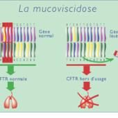 Quelle lutte contre la mucoviscidose ?