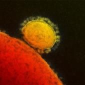 Un coronavirus meurtrier, mais peu contagieux
