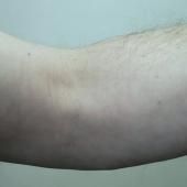Voir la vidéo de Comprendre la réparation musculaire / Isabelle Marty