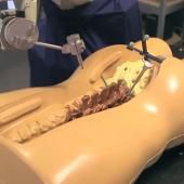 Voir la vidéo de Les robots chirurgiens