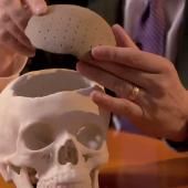 Voir la vidéo de Des greffes osseuses innovantes