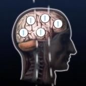 Voir la vidéo de L'IRM : Imagerie par Résonance Magnétique