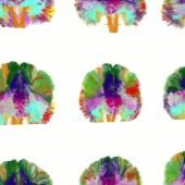 Voir la vidéo de NeuroSpin, le cerveau en action