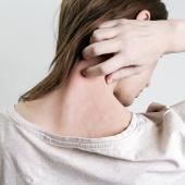 Mémoire cutanée dans l’eczéma allergique