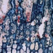 Voir la vidéo de Klimt et les ostéoclastes