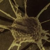 Voir la vidéo de L&#039;araignée et le neurone