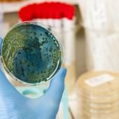 Antibiotiques : l’Inserm annonce la création de deux nouvelles molécules candidates
