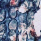 See video of Klimt and osteoclasts