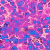 See video of Redon and astrocytes