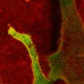 See video of Cave painting and kidney