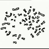 Voir la vidéo de Microscope optique / 1er caryotype