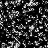 Virus, bactéries et autres microbes