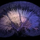 See video of Kidney, the filter of life