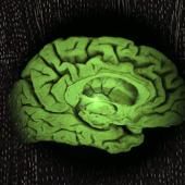 See video of Alzheimer, the memory engulfed