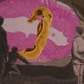 See video of Schistosomiasis, the monster of stagnant water sources
