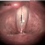 Voir la vidéo de Exploration du conduit vocal
