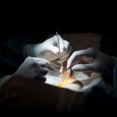 Greffes d’organes : une centaine de plus en 2019