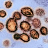 France : lancement d’un essai clinique sur le coronavirus