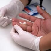 Deuxième cas mondial de guérison d’un patient atteint du VIH 