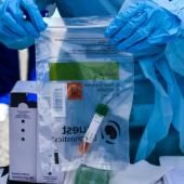 Les États-Unis ont commencé des tests d’immunité au coronavirus