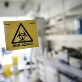 Les « orages de cytokine », emballements funestes des cas graves de Covid-19