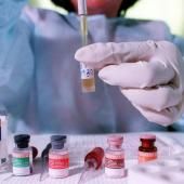 VIH : une rémission constatée, sans greffe de moelle ?