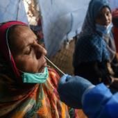 Coronavirus : un test rapide de diagnostic pour la fin septembre ?