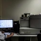 Cancer du côlon : un logiciel qui prédit une possible rechute, fiable à 85 %