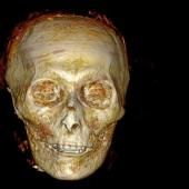 Amenhotep Ier, momifié avec le cerveau et les bras en croix