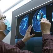 Cancer, la recherche progresse