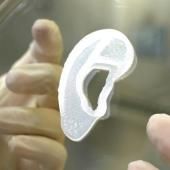 Un chirurgien a greffé un implant d’oreille imprimé à partir de cellules humaines