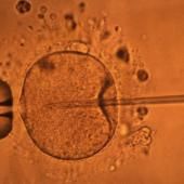 La concentration en spermatozoïdes connaîtrait un déclin mondial depuis plusieurs décennies